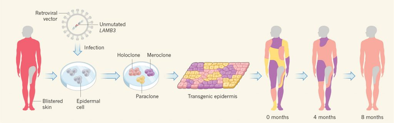 Illustration showing how gene therapy was used to treat a skin disease. (Image: Nature News & Views)